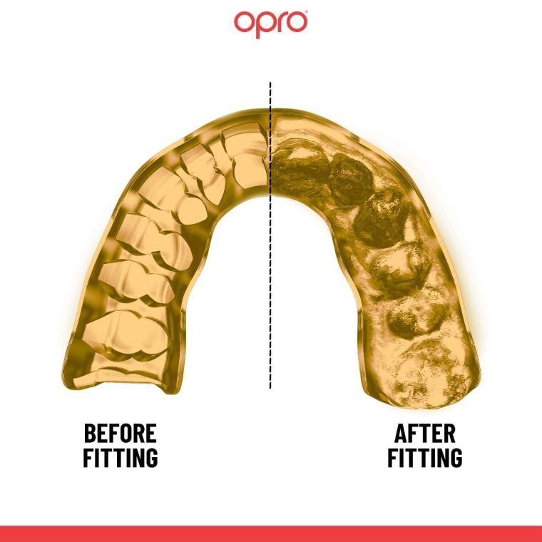 OPRO Mouth Guard UFC Strike Gold White Gold Instant Custom